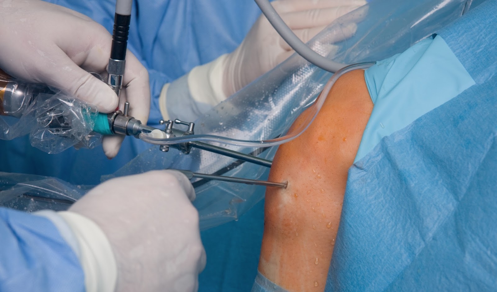 Procedimiento Quirúrgico más frecuente